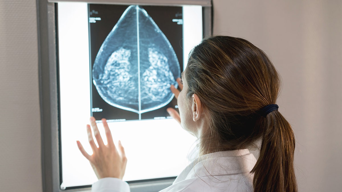 The FDA approves the first AI tool to predict the risk of breast cancer